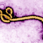 some major symptoms of ebola