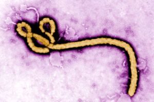 some major symptoms of ebola