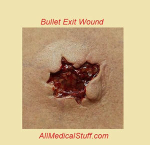 butllet exit wounds