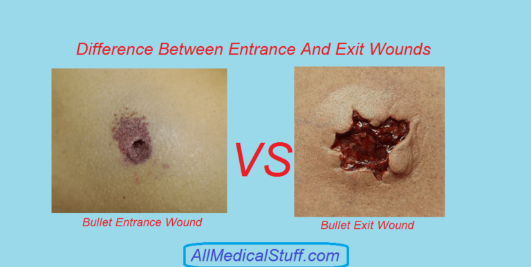 Entry And Exit Wound Chart